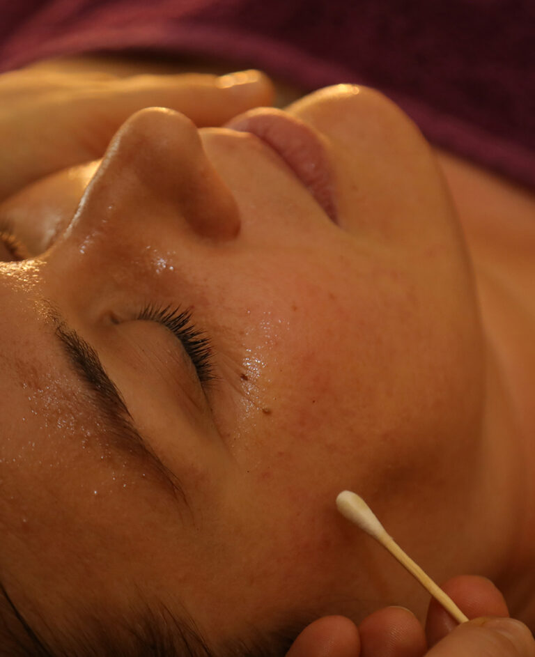 Despigmentante-facial